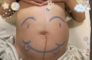 孕婦按摩 精選圖片