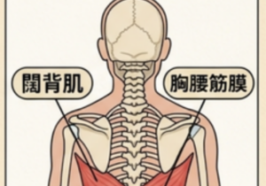 胸腰筋膜/下背痛